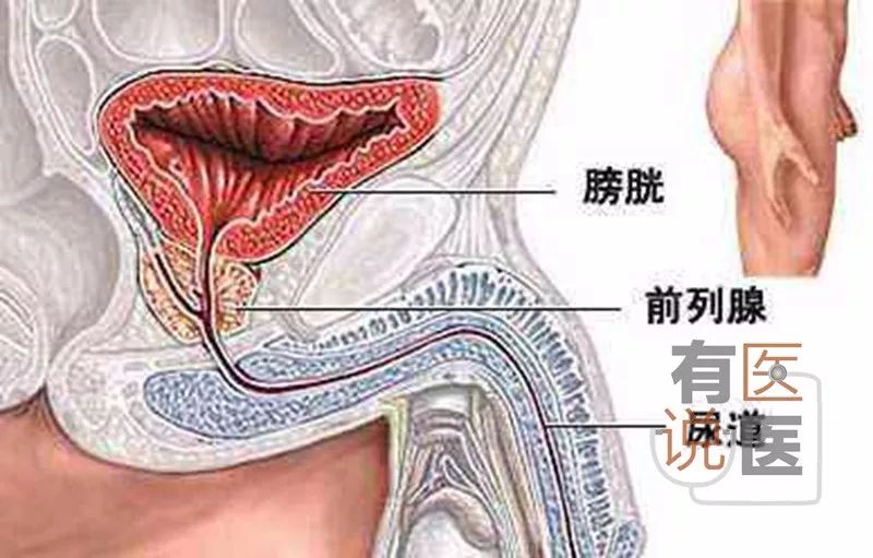 膀胱起搏器最新進展，科技革新引領(lǐng)尿路管理新紀(jì)元